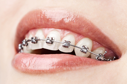 We have the best Orthodontist in North Ryde.
