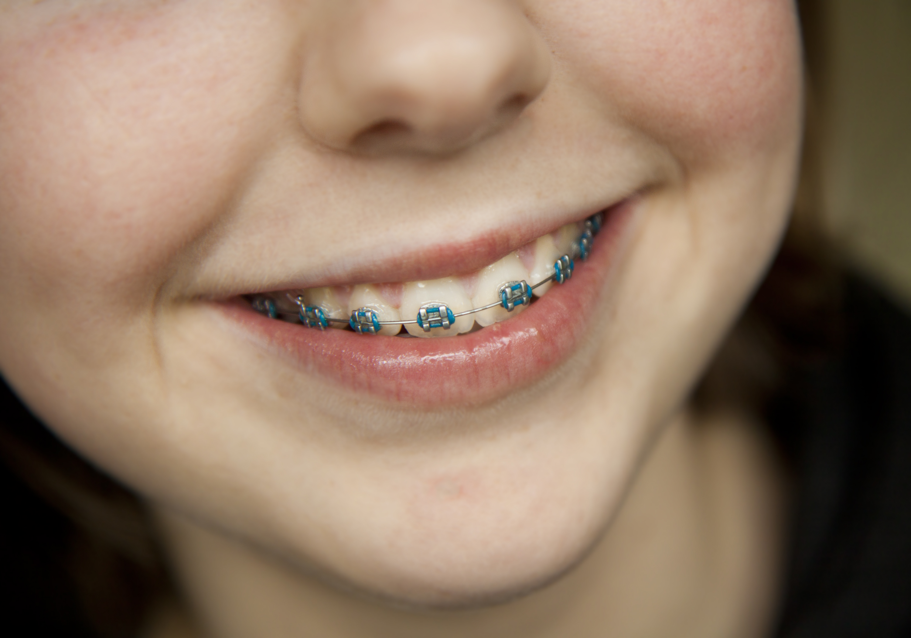We have the experts of Orthodontics in North Ryde.