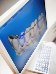 Here's how we make dental crowns in Macquarie Park