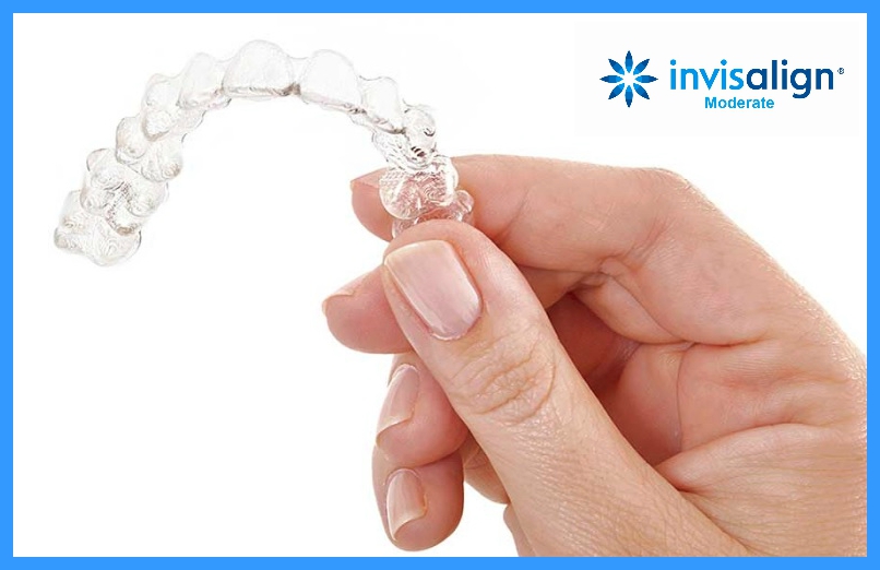 Invisalign Moderate