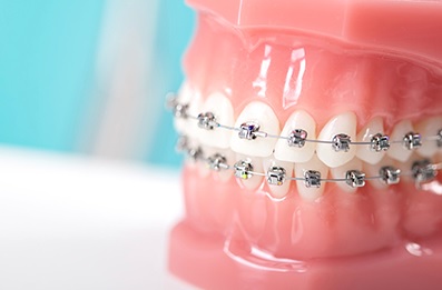 Orthodontics in Macquarie park