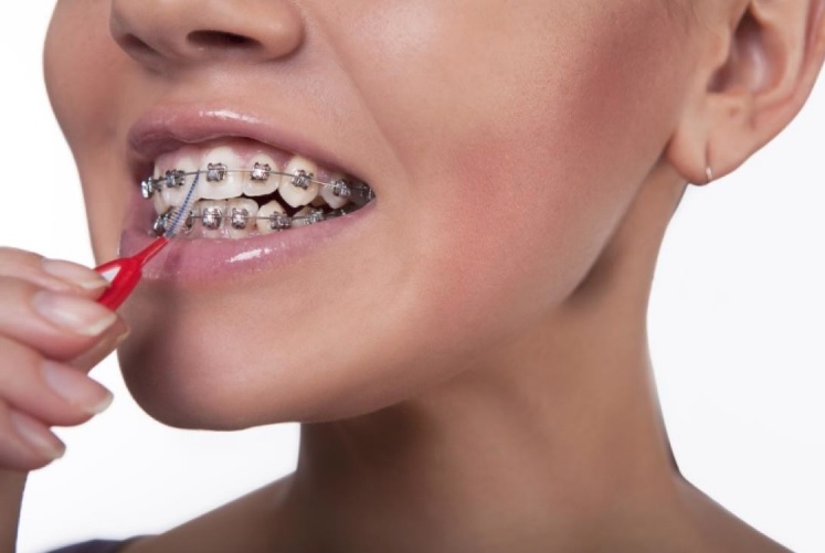 We have the best orthodontist in Macquarie Park.