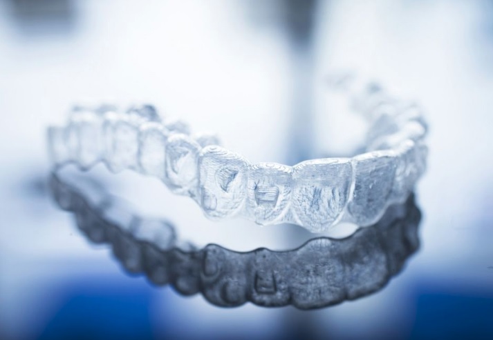 Invisalign in Macquarie Park