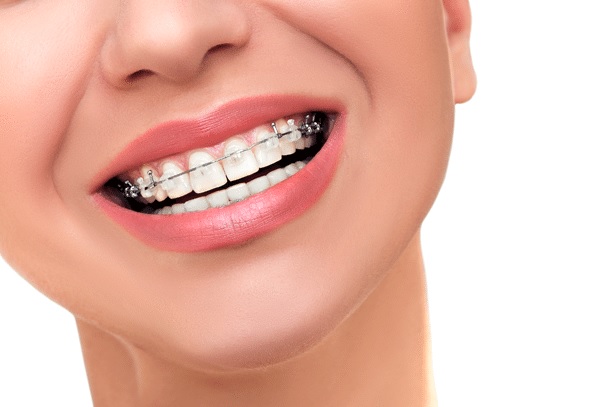 Orthodontics in North Ryde