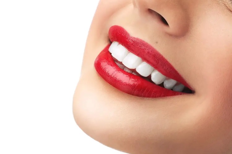 professional teeth whitening dentist in North Ryde