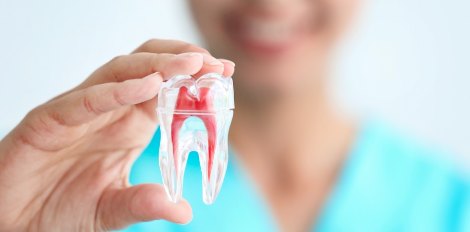 root canal cost in North Ryde