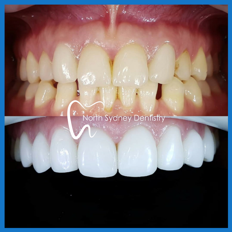 cosmetic dentistry in North Ryde