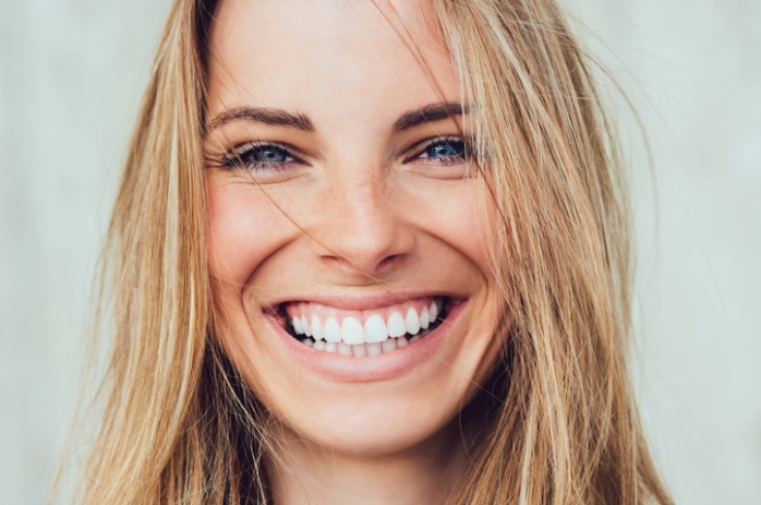veneers in North Ryde