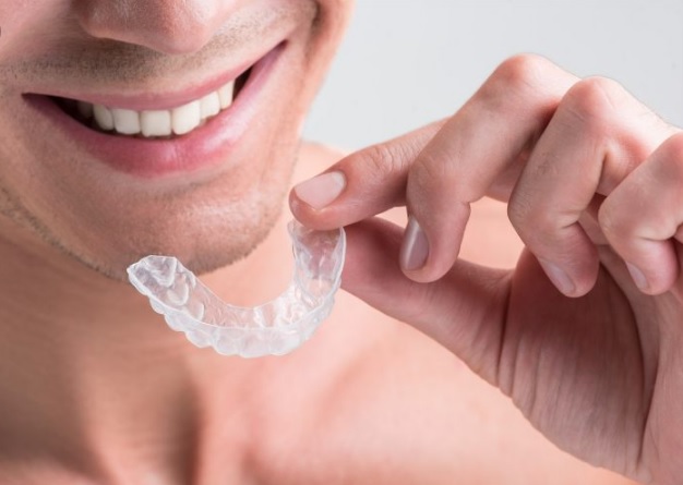 invisalign cost in North Ryde