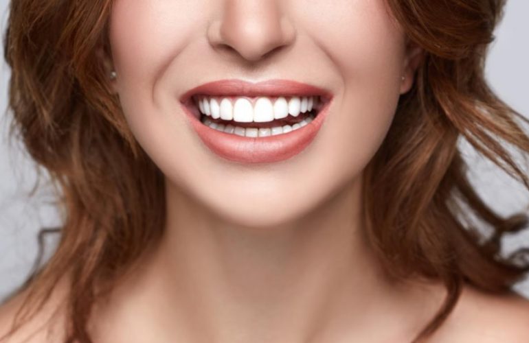 Porcelain Veneers Sydney