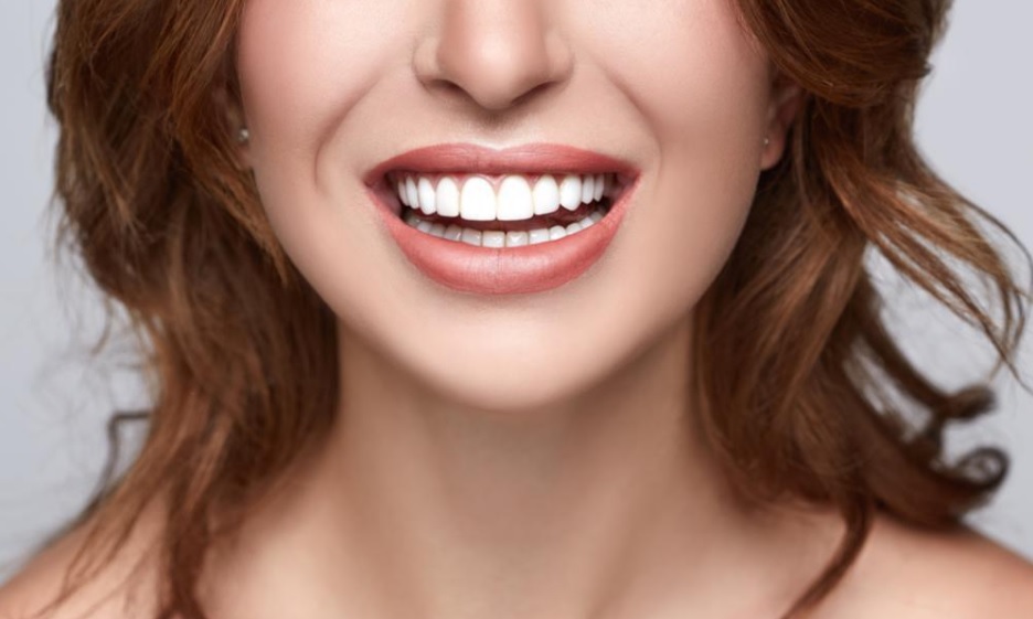 Porcelain Veneers Sydney