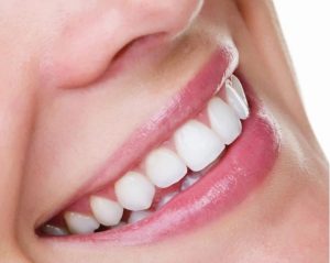 Best Teeth Whitening Sydney