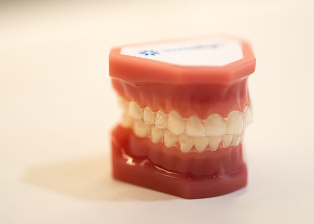 Invisalign clear aligners at North Ryde Dentistry