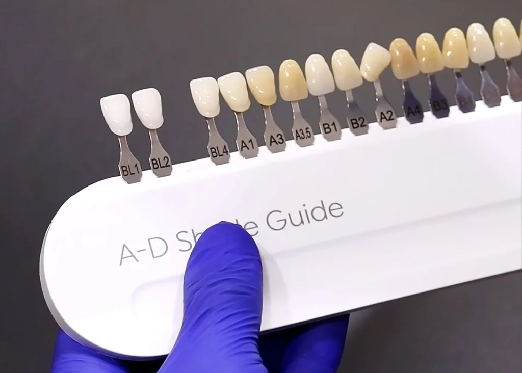A dental teeth whitening shade guide showing a spectrum of tooth colors arranged from darkest to brightest white.