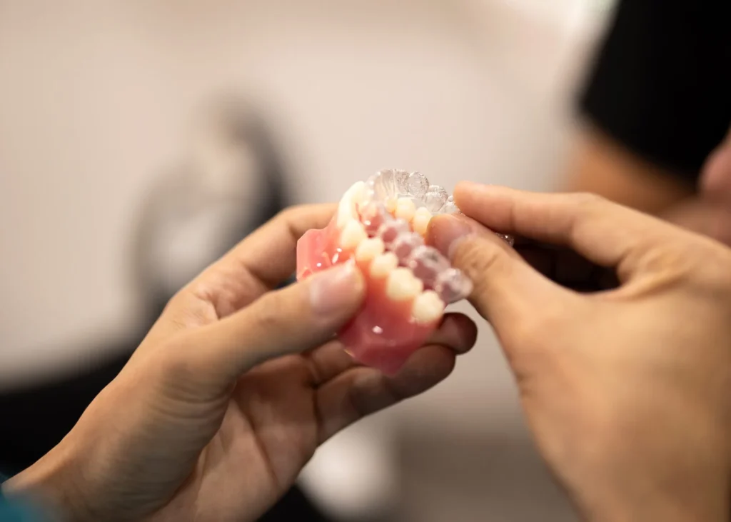 Invisalign from North Ryde Dentistry