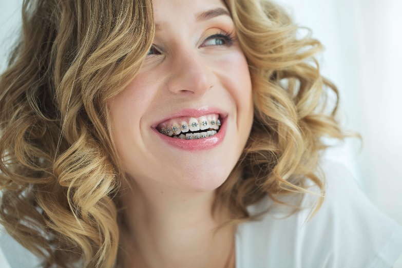 Braces and Aligners: Understanding the Cost