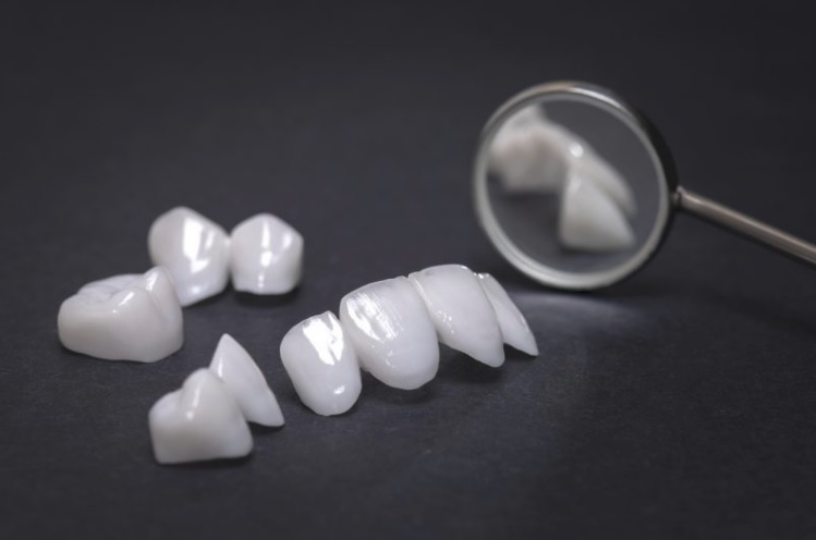 Dental Veneers: Pros and Cons