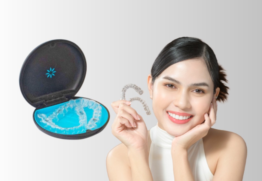 Looking for Invisalign Near Macquarie Park?