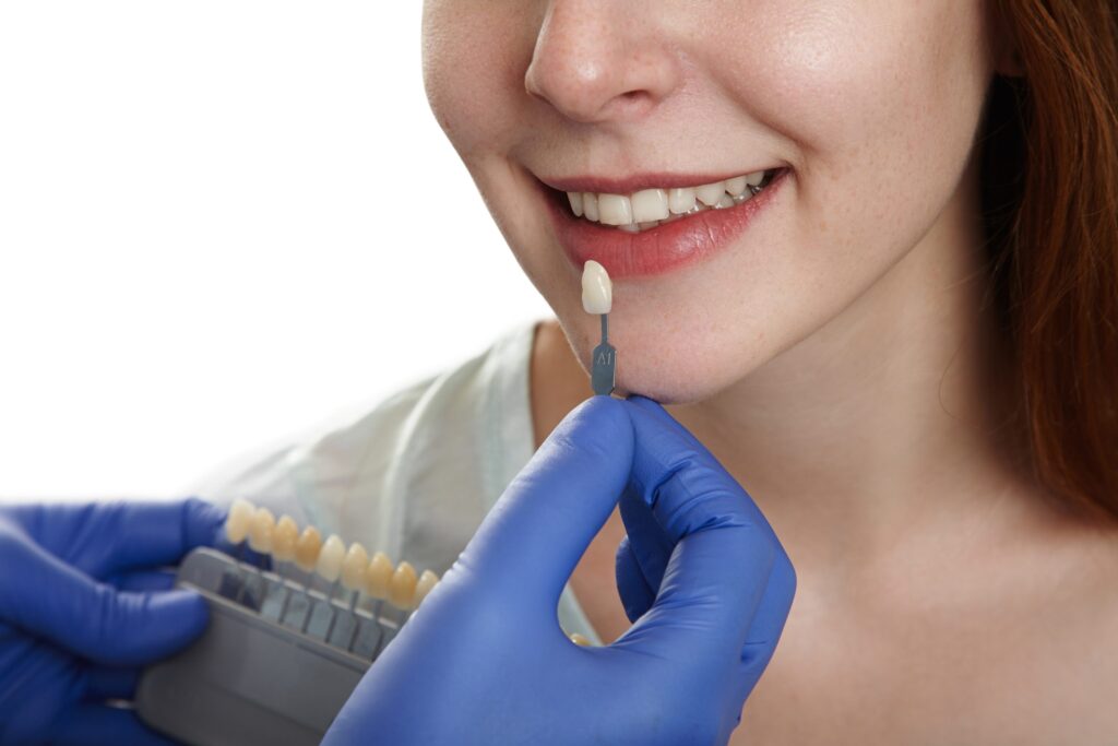 Porcelain Veneers: Questions to Ask Your Dentist
